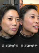 妙医堂精手法传承人——王浩丞 妙医堂精手法传承人——王浩丞