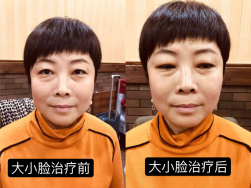 妙医堂精手法传承人——王浩丞 妙医堂精手法传承人——王浩丞